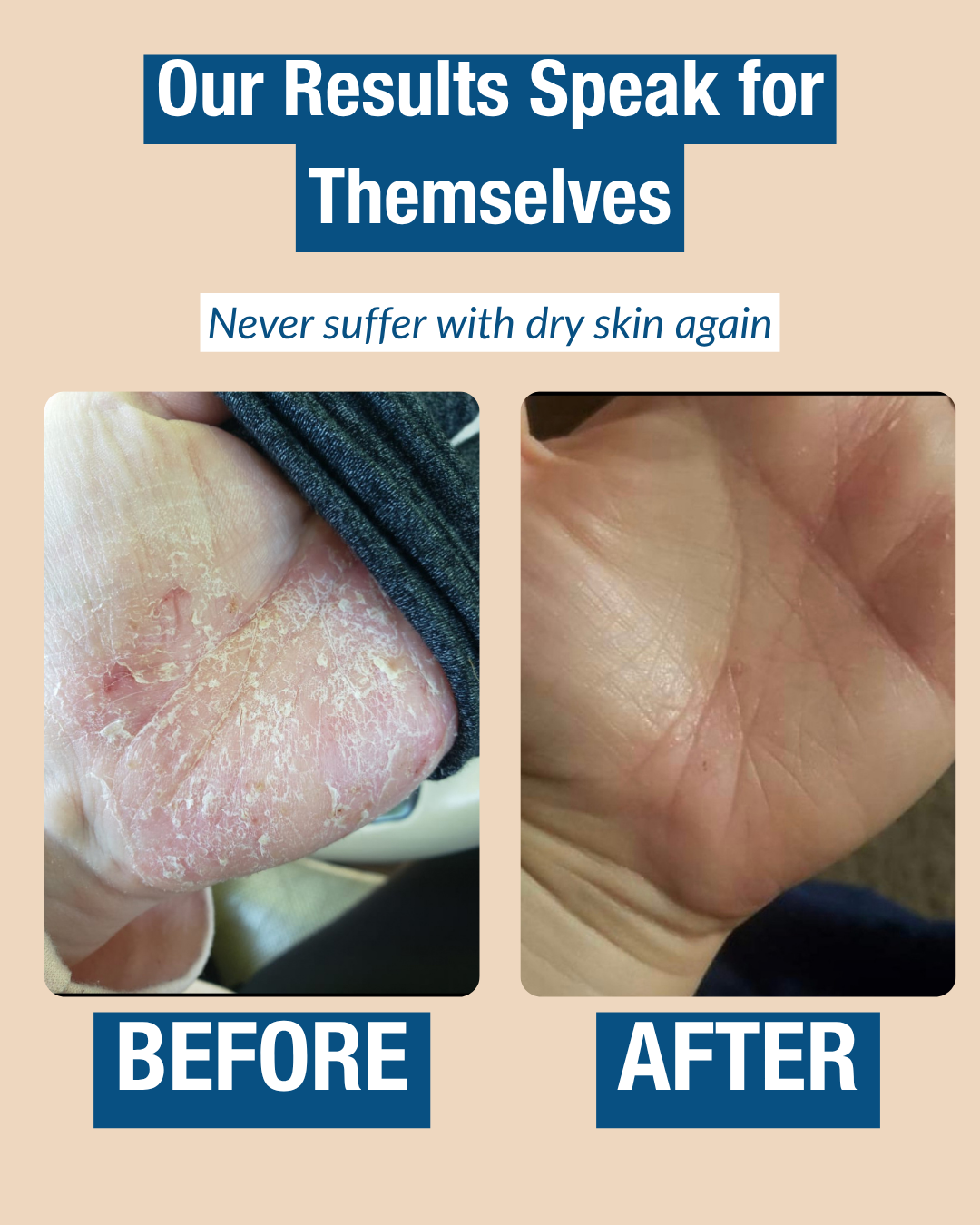 Rescue Your Dry Skin—Solid Face & Body Balm